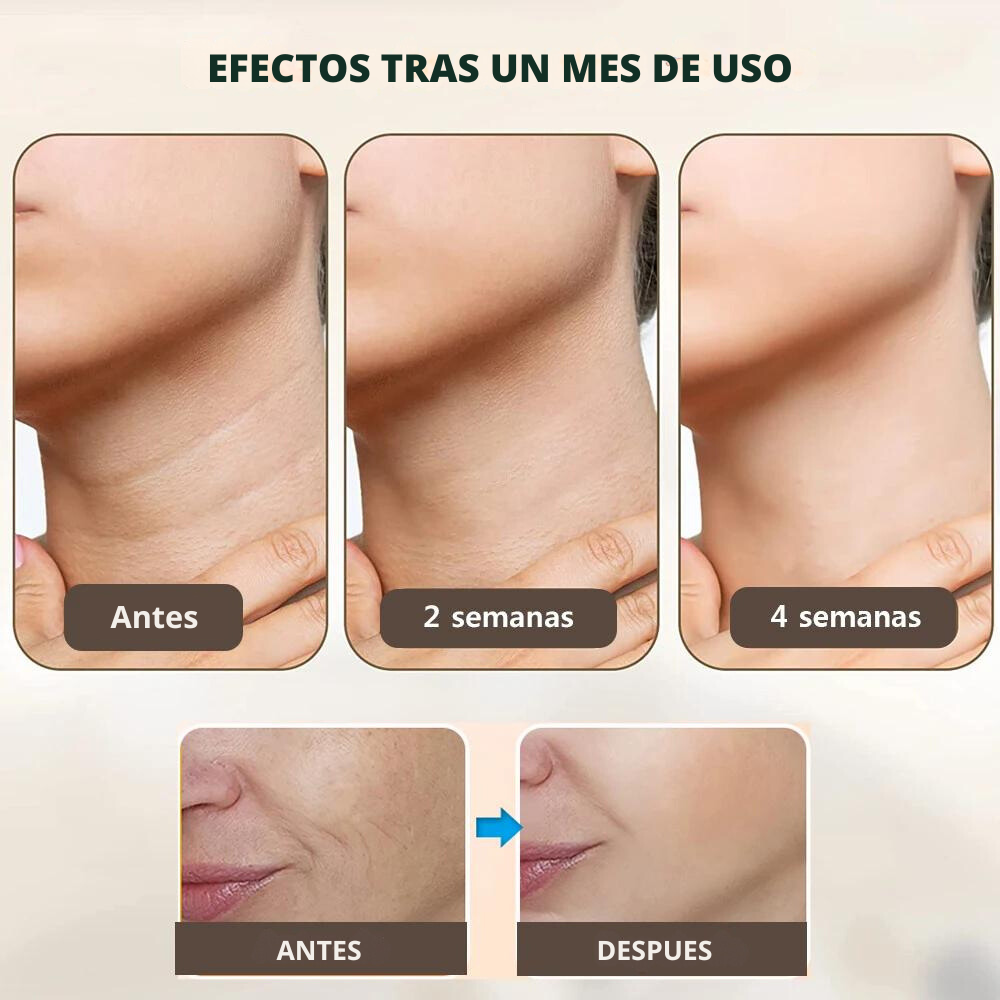 Reductor de Arrugas e Imperfecciones -  Lifting Facial™