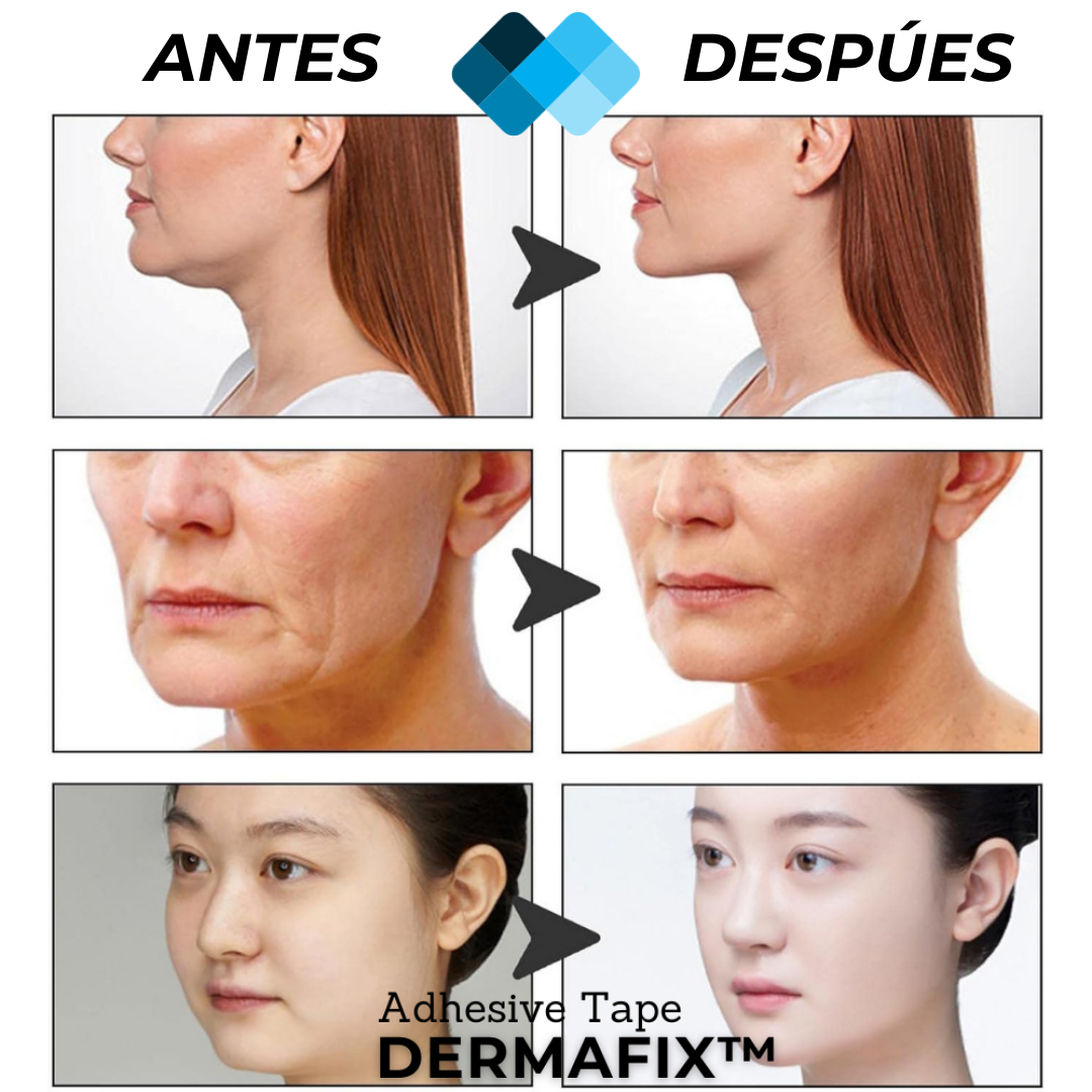 Tiras de Lifting facial efecto Natural "Buena Cara" l BeautySide™